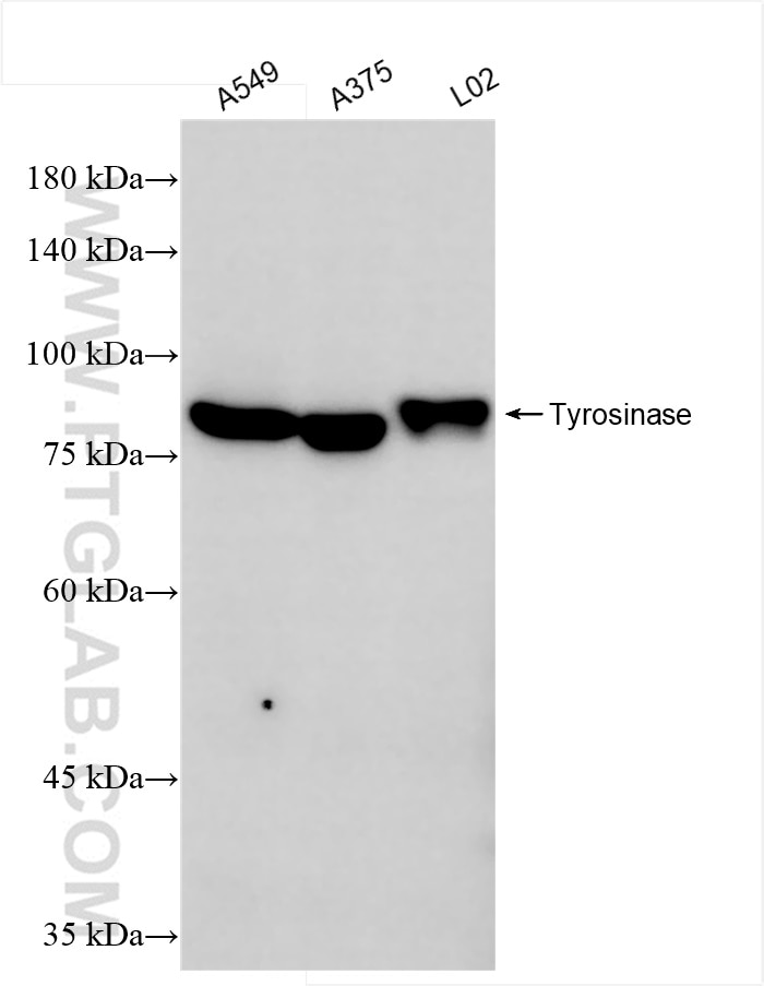 Western Blot (WB) analysis of various lysates using Tyrosinase Recombinant antibody (84723-3-RR)