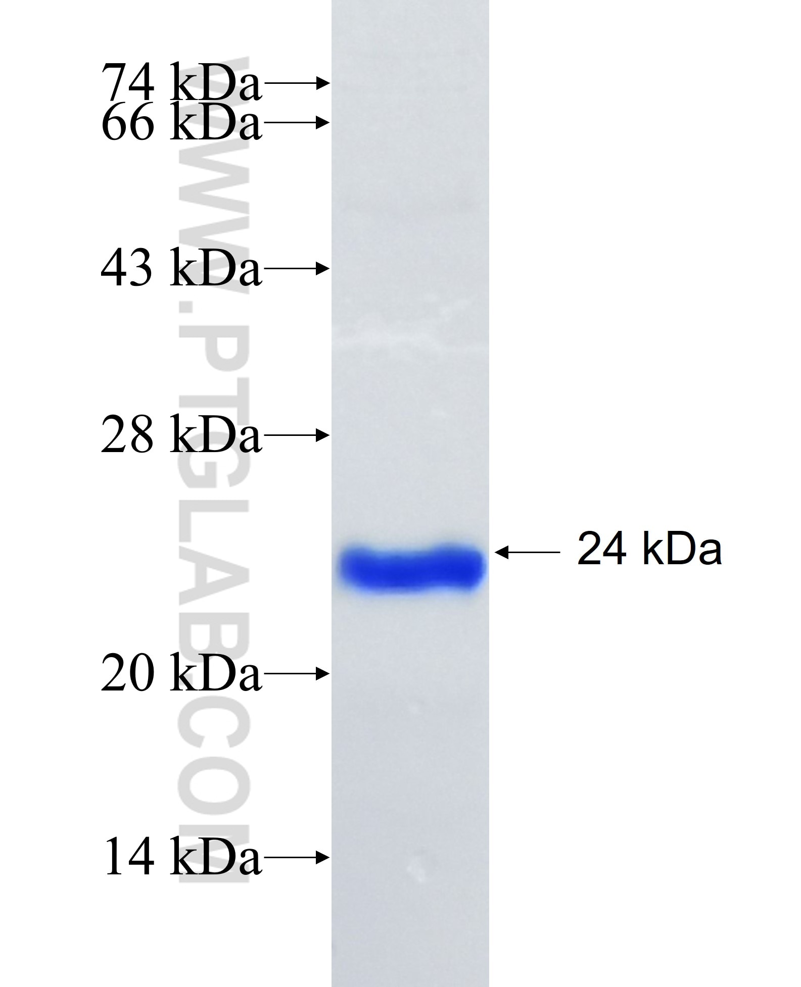 Tyrosinase fusion protein Ag34982 SDS-PAGE