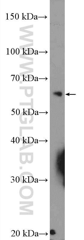 Western Blot (WB) analysis of HepG2 cells using U2AF65 Polyclonal antibody (15624-1-AP)