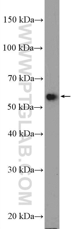 Western Blot (WB) analysis of HeLa cells using U2AF65 Polyclonal antibody (15624-1-AP)