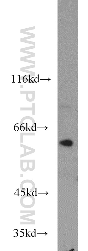 Western Blot (WB) analysis of Jurkat cells using U2AF65 Polyclonal antibody (15624-1-AP)