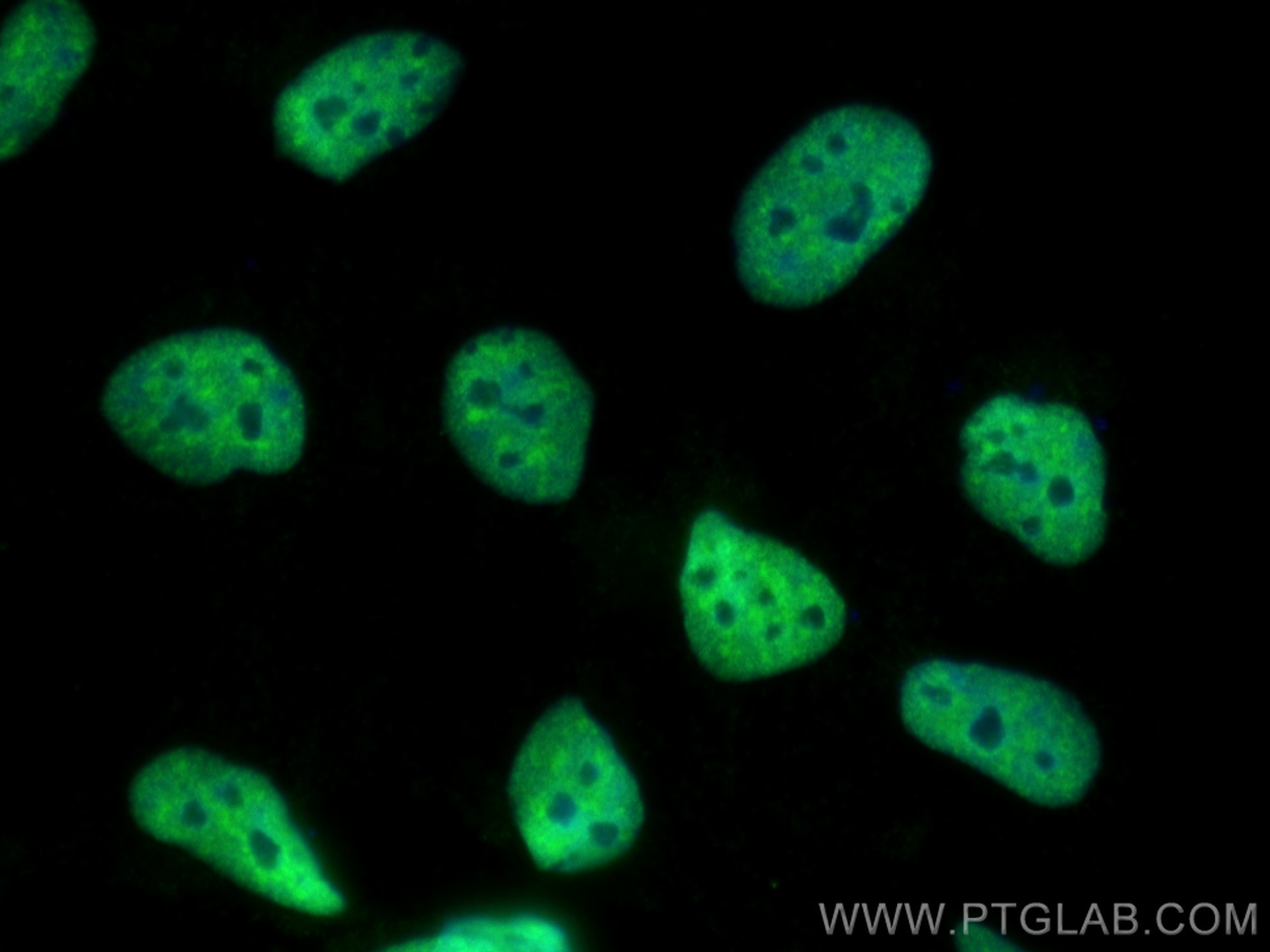 Immunofluorescence (IF) / fluorescent staining of HEK-293 cells using U2AF2/U2AF65 Monoclonal antibody (68166-1-Ig)