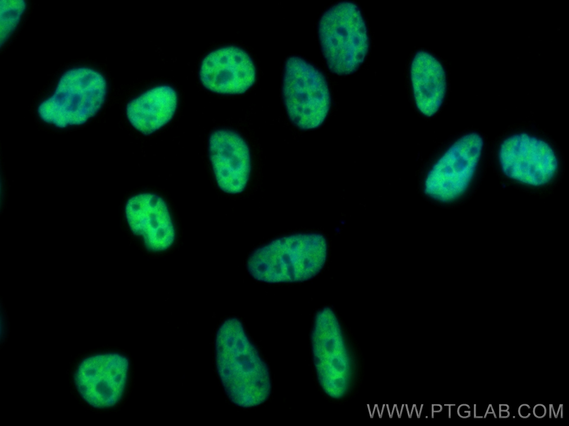 IF Staining of HEK-293 using 68166-1-Ig