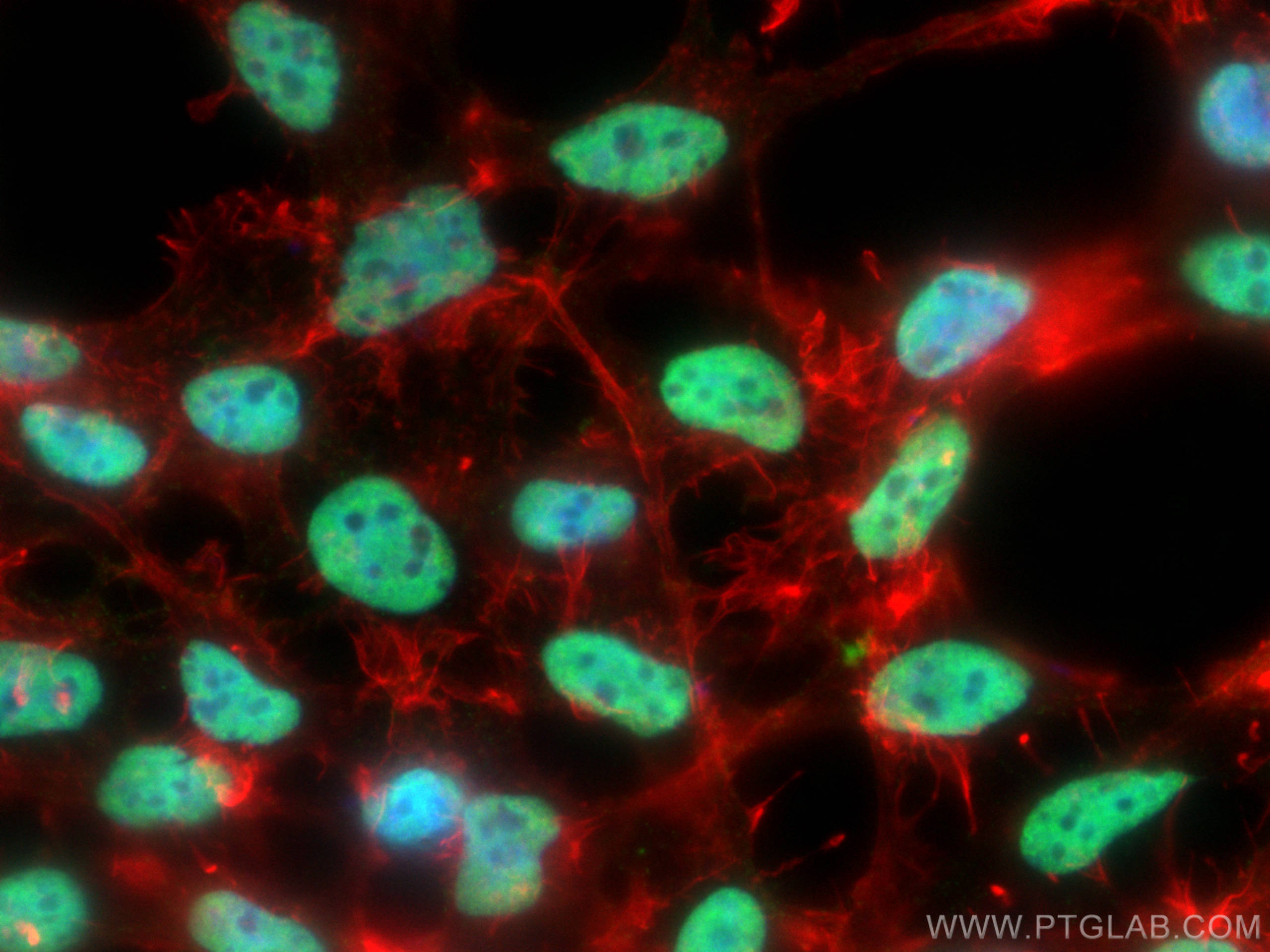 Immunofluorescence (IF) / fluorescent staining of HEK-293 cells using U2AF2/U2AF65 Monoclonal antibody (68166-1-Ig)