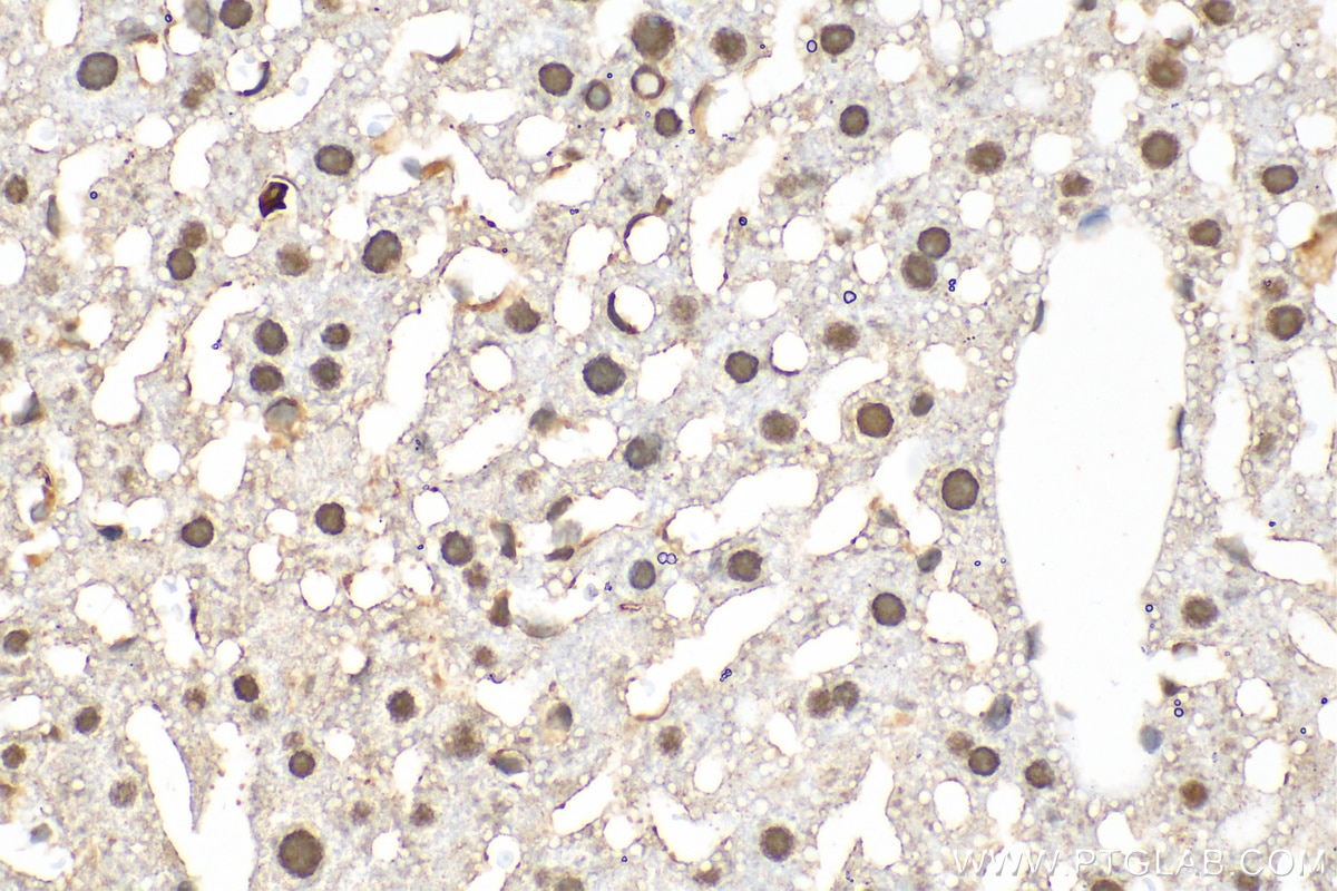 Immunohistochemistry (IHC) staining of mouse liver tissue using U2AF2/U2AF65 Monoclonal antibody (68166-1-Ig)