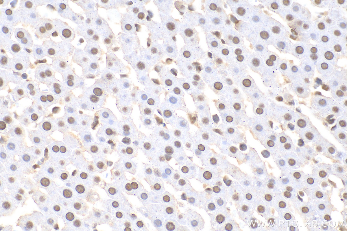 Immunohistochemistry (IHC) staining of rat liver tissue using U2AF2/U2AF65 Monoclonal antibody (68166-1-Ig)