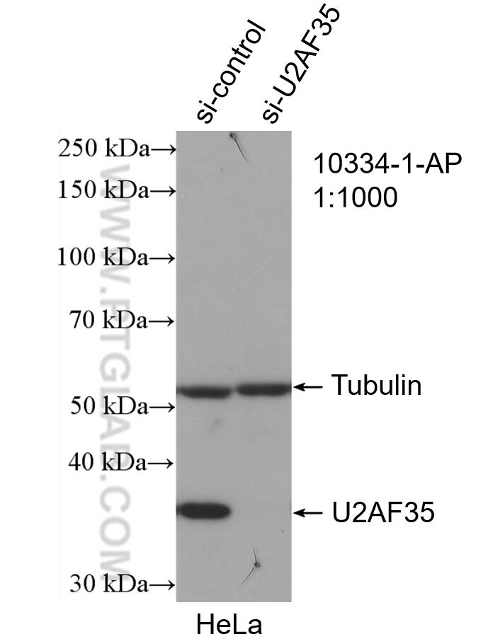 Western Blot (WB) analysis of HeLa cells using U2AF35 Polyclonal antibody (10334-1-AP)