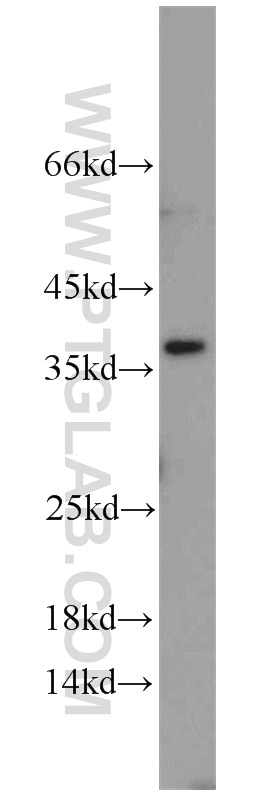 Western Blot (WB) analysis of HeLa cells using U2AF35 Polyclonal antibody (10334-1-AP)