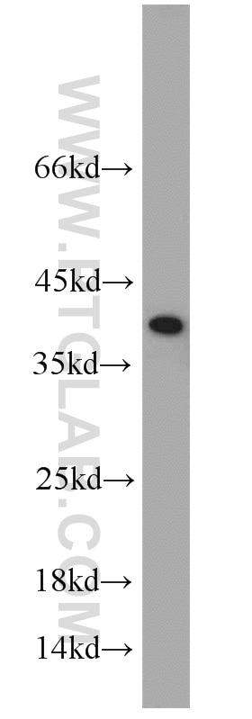Western Blot (WB) analysis of COLO 320 cells using U2AF35 Polyclonal antibody (10334-1-AP)