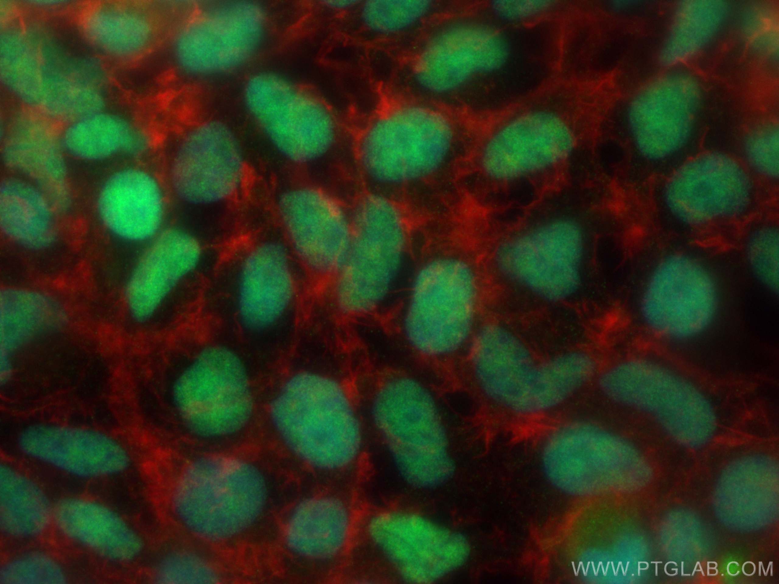 Immunofluorescence (IF) / fluorescent staining of HEK-293 cells using U2AF35 Monoclonal antibody (60289-1-Ig)