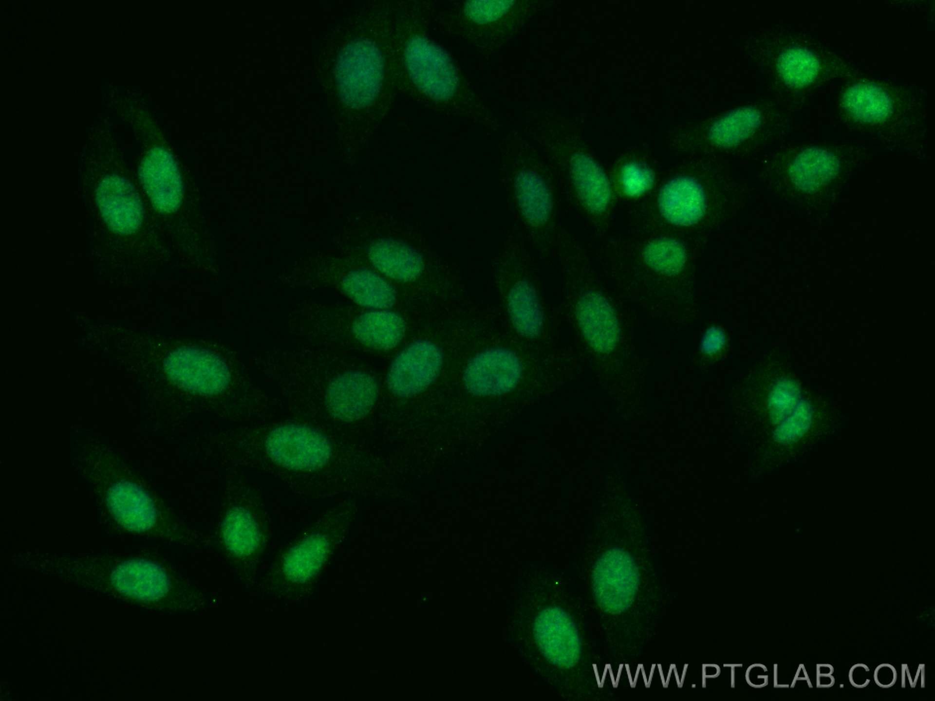Immunofluorescence (IF) / fluorescent staining of HepG2 cells using U2AF35 Monoclonal antibody (60289-1-Ig)