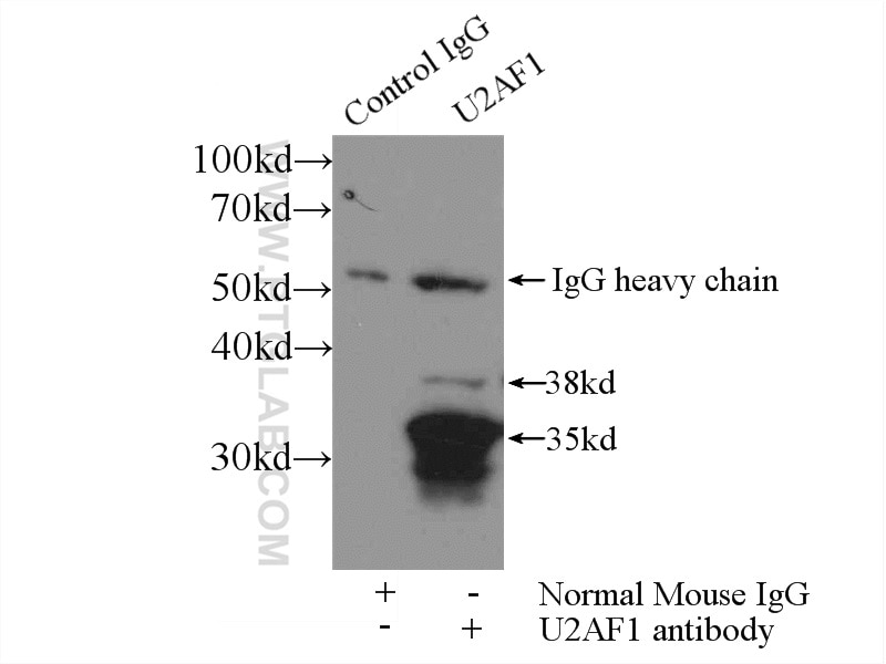 Immunoprecipitation (IP) experiment of HeLa cells using U2AF35 Monoclonal antibody (60289-1-Ig)