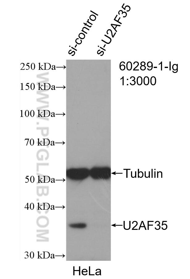 Western Blot (WB) analysis of HeLa cells using U2AF35 Monoclonal antibody (60289-1-Ig)