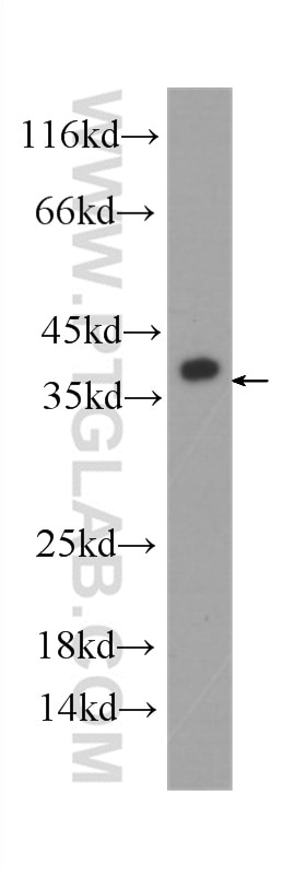 Western Blot (WB) analysis of COLO 320 cells using U2AF35 Monoclonal antibody (60289-1-Ig)