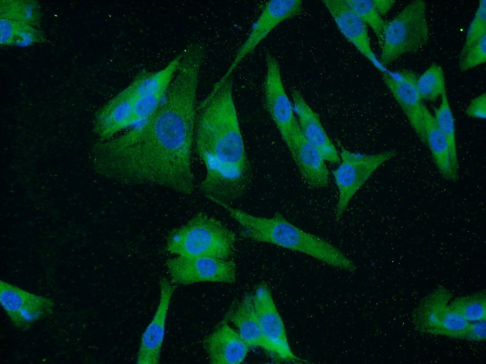 Immunofluorescence (IF) / fluorescent staining of A375 cells using UACA Polyclonal antibody (25654-1-AP)