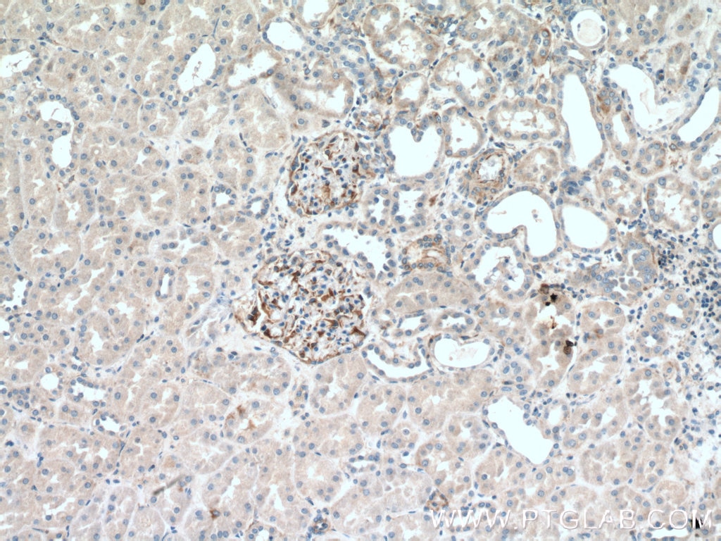 Immunohistochemistry (IHC) staining of human kidney tissue using UACA Polyclonal antibody (25654-1-AP)