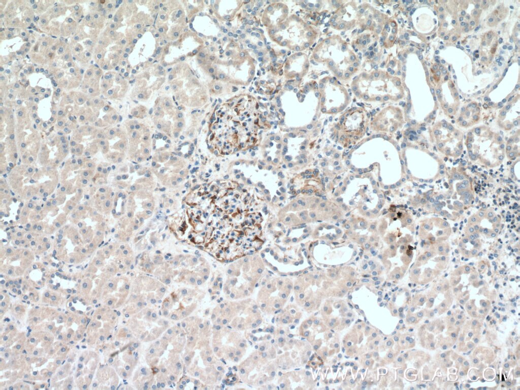 Immunohistochemistry (IHC) staining of human kidney tissue using UACA Polyclonal antibody (25654-1-AP)