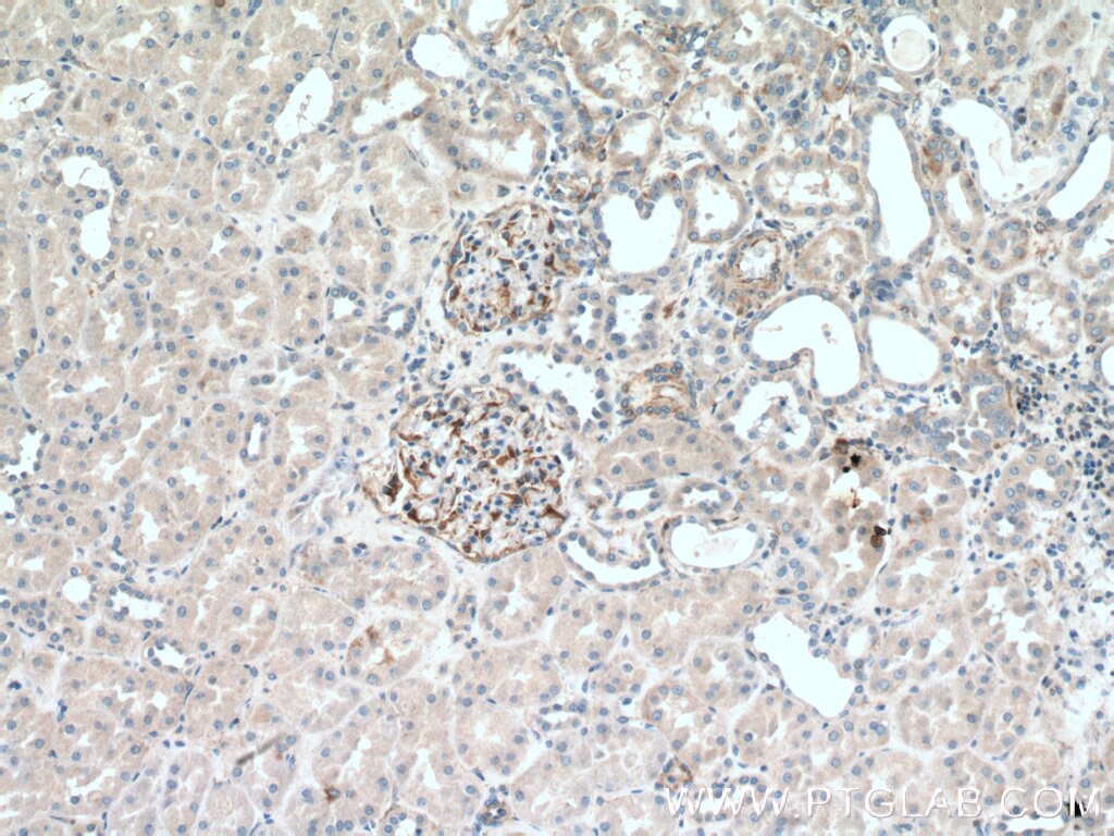 Immunohistochemistry (IHC) staining of human kidney tissue using UACA Polyclonal antibody (25654-1-AP)