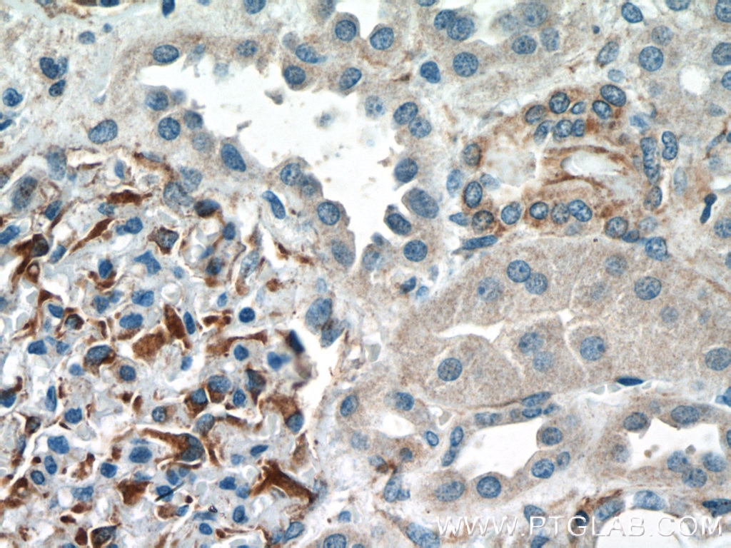 Immunohistochemistry (IHC) staining of human kidney tissue using UACA Polyclonal antibody (25654-1-AP)