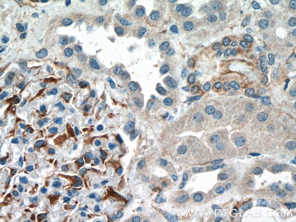 IHC staining of human kidney using 25654-1-AP