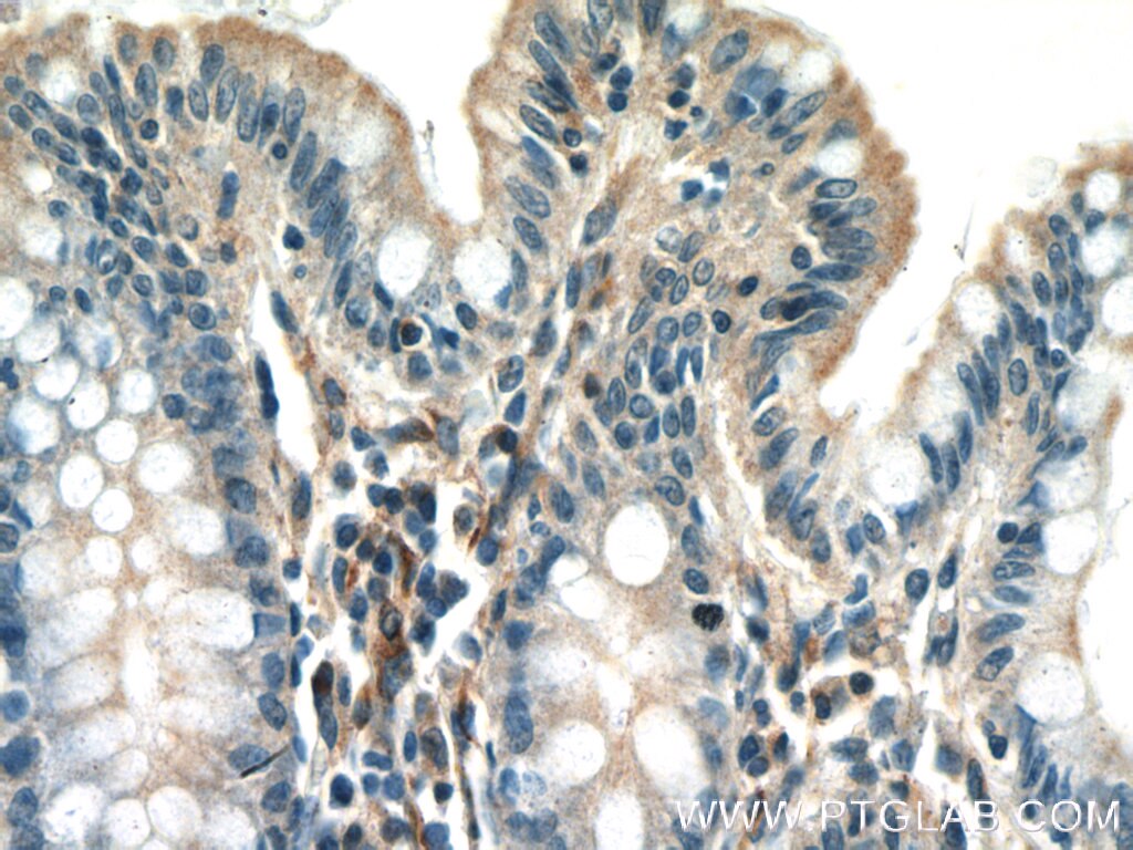 Immunohistochemistry (IHC) staining of human colon tissue using UACA Polyclonal antibody (25654-1-AP)