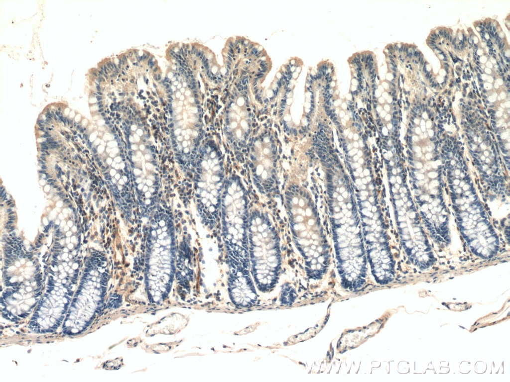 IHC staining of human colon using 25654-1-AP