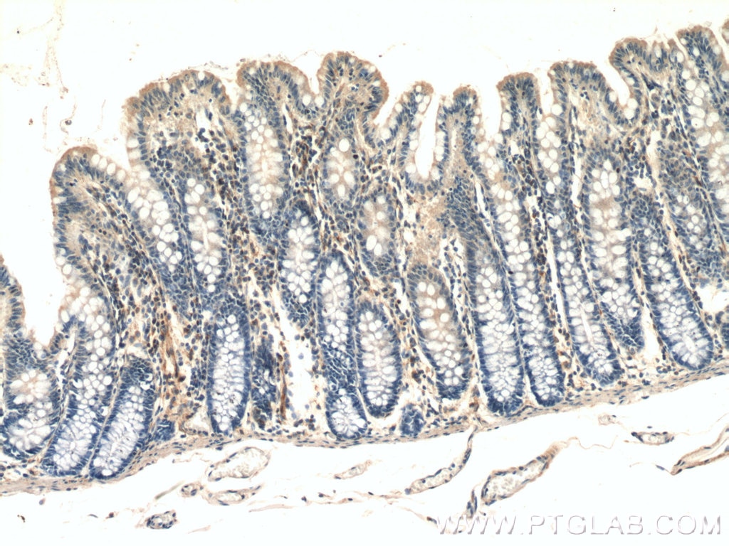 Immunohistochemistry (IHC) staining of human colon tissue using UACA Polyclonal antibody (25654-1-AP)