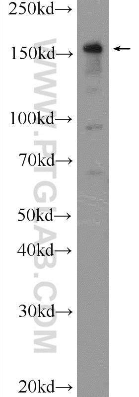 WB analysis of Neuro-2a using 25654-1-AP