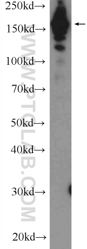 Western Blot (WB) analysis of HEK-293 cells using UACA Polyclonal antibody (25654-1-AP)