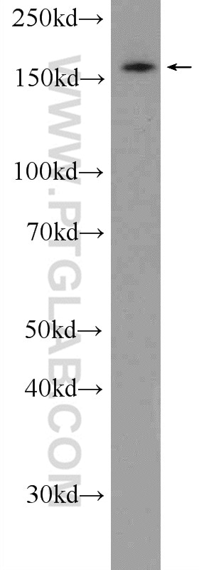 Western Blot (WB) analysis of Y79 cells using UACA Polyclonal antibody (25654-1-AP)