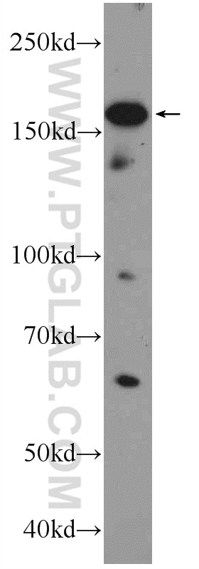 Western Blot (WB) analysis of Neuro-2a cells using UACA Polyclonal antibody (25654-1-AP)