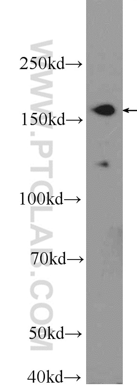 Western Blot (WB) analysis of Y79 cells using UACA Polyclonal antibody (25654-1-AP)