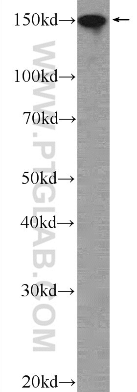 Western Blot (WB) analysis of HeLa cells using UACA Polyclonal antibody (25654-1-AP)