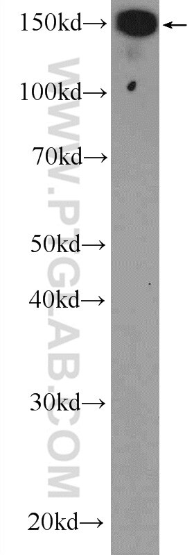 Western Blot (WB) analysis of A375 cells using UACA Polyclonal antibody (25654-1-AP)