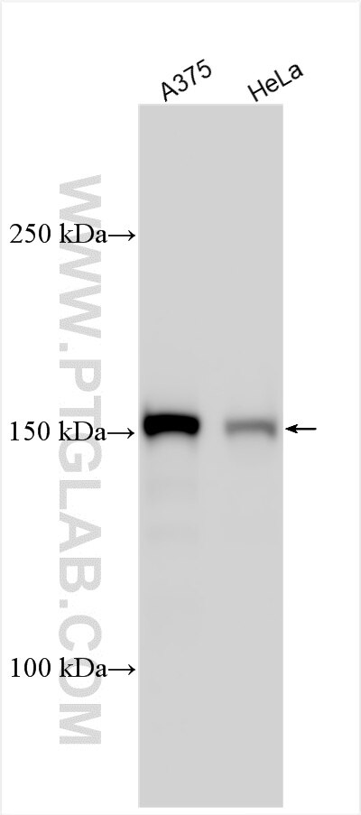 Western Blot (WB) analysis of various lysates using UACA Polyclonal antibody (25654-1-AP)