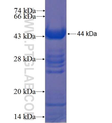 UACA fusion protein Ag22404 SDS-PAGE