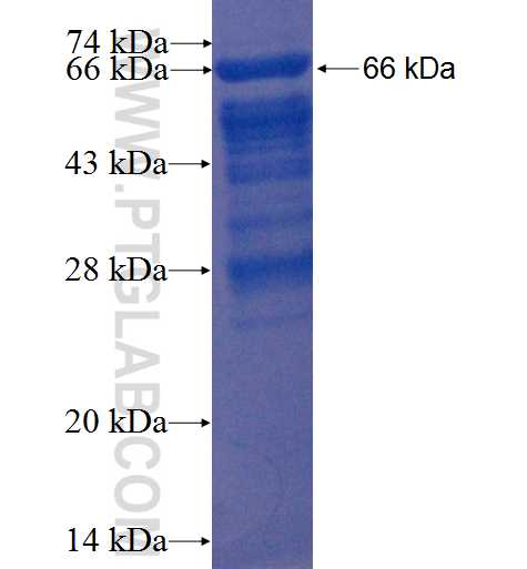 UACA fusion protein Ag22438 SDS-PAGE
