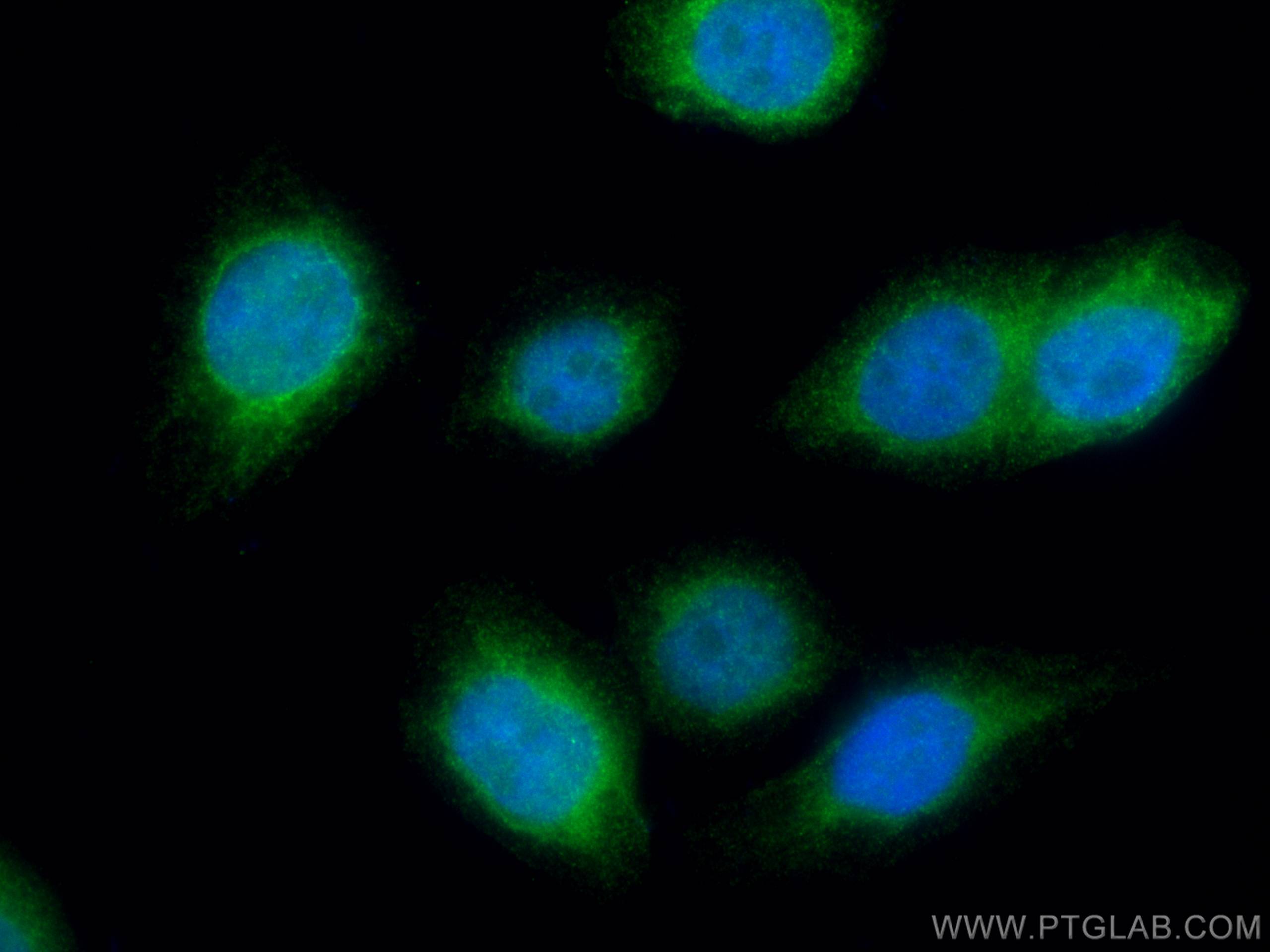 Immunofluorescence (IF) / fluorescent staining of PC-3 cells using UAP1 Polyclonal antibody (16318-1-AP)