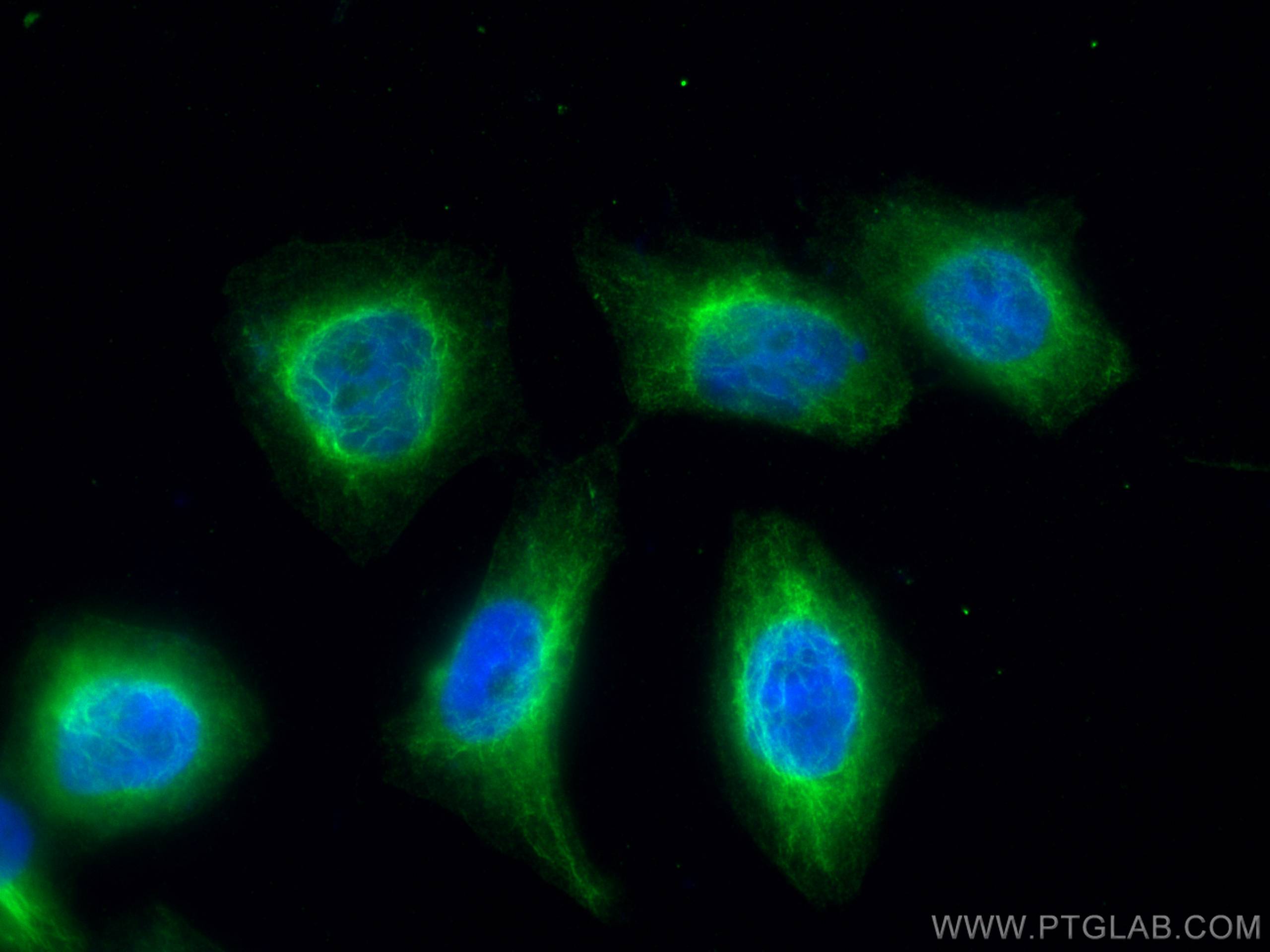 Immunofluorescence (IF) / fluorescent staining of PC-3 cells using UAP1 Monoclonal antibody (67545-1-Ig)