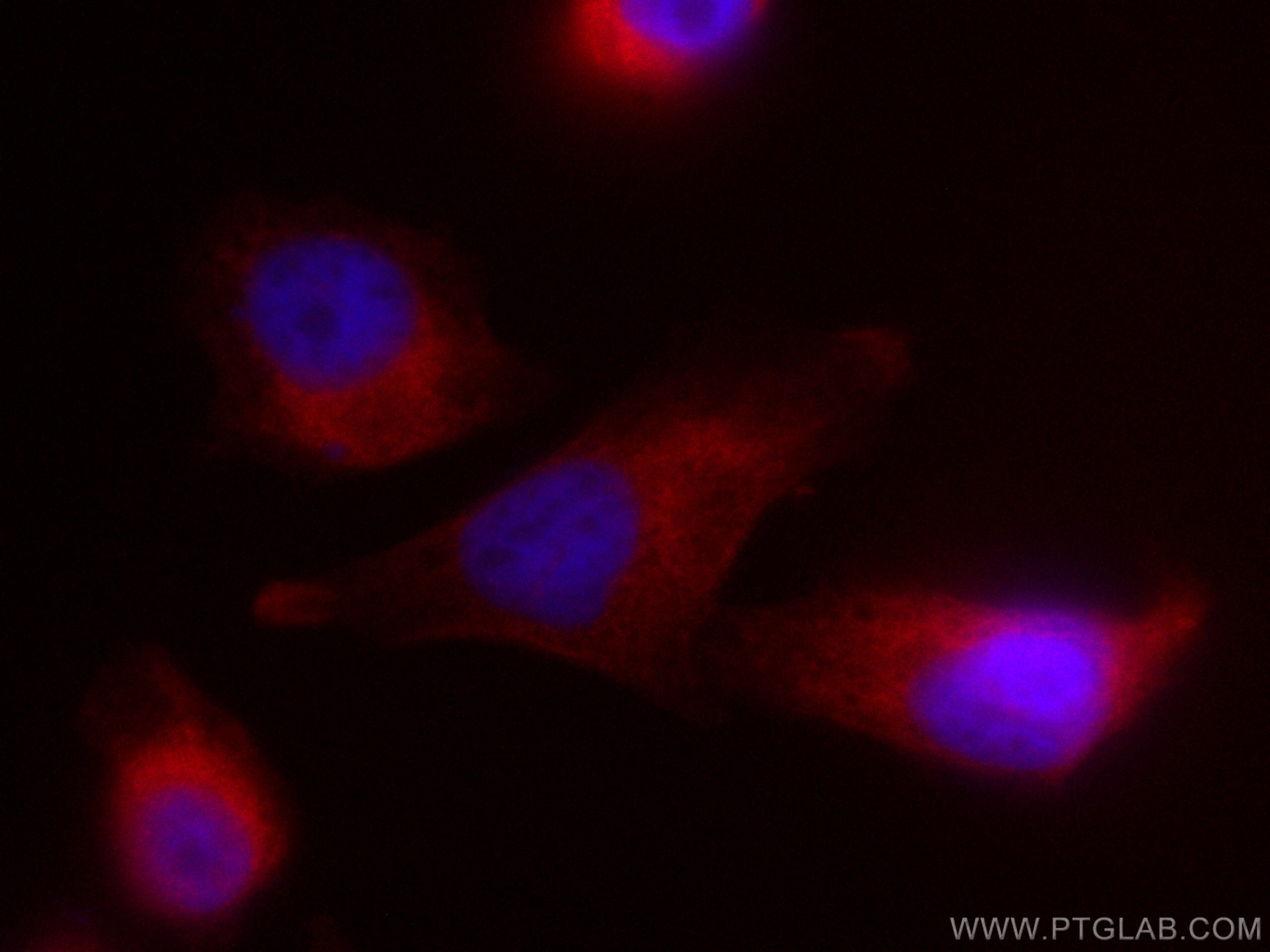 Immunofluorescence (IF) / fluorescent staining of PC-3 cells using CoraLite®594-conjugated UAP1 Monoclonal antibody (CL594-67545)