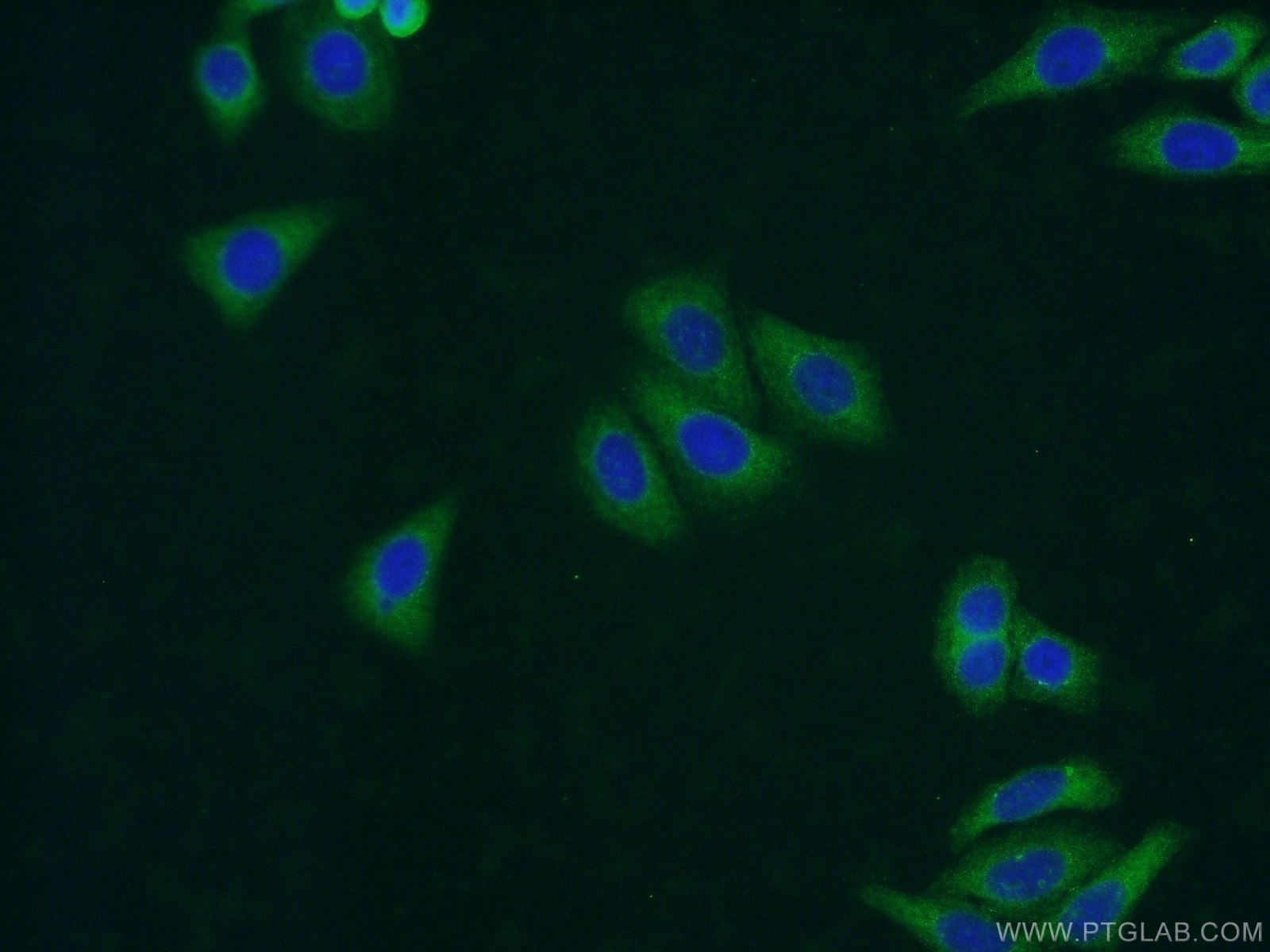 Immunofluorescence (IF) / fluorescent staining of HepG2 cells using UAP1L1 Polyclonal antibody (25262-1-AP)