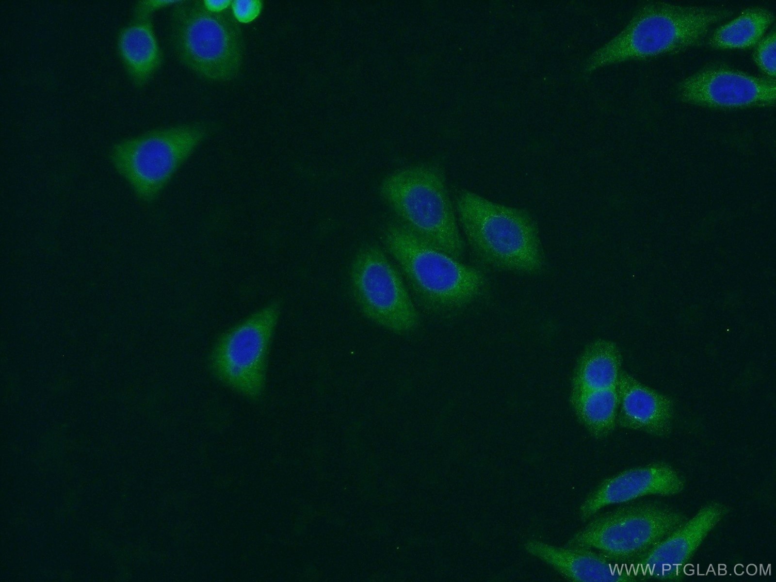 IF Staining of HepG2 using 25262-1-AP