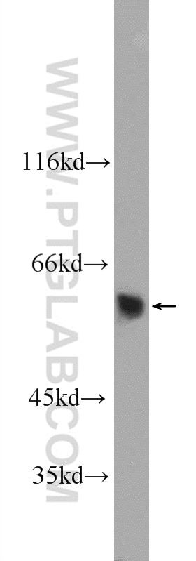 Western Blot (WB) analysis of A375 cells using UAP1L1 Polyclonal antibody (25262-1-AP)