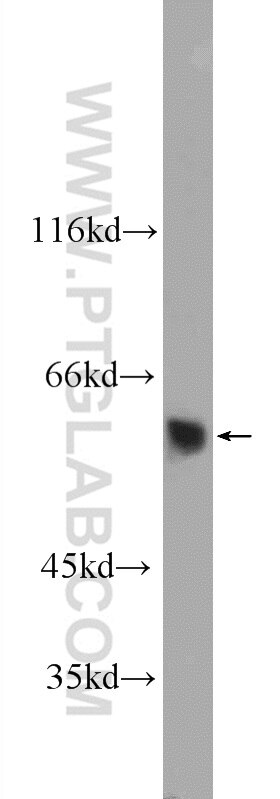 WB analysis of A375 using 25262-1-AP