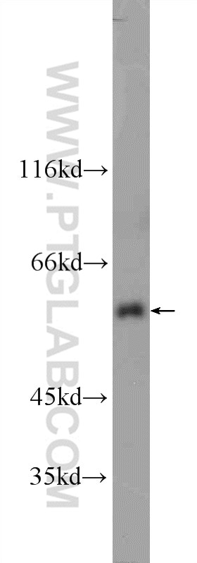 Western Blot (WB) analysis of K-562 cells using UAP1L1 Polyclonal antibody (25262-1-AP)
