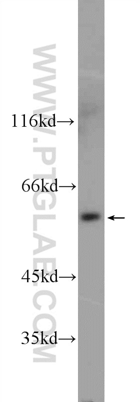 Western Blot (WB) analysis of MDA-MB-453s cells using UAP1L1 Polyclonal antibody (25262-1-AP)