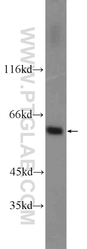 Western Blot (WB) analysis of HepG2 cells using UAP1L1 Polyclonal antibody (25262-1-AP)