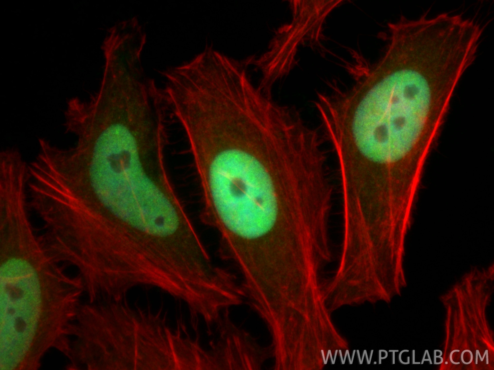 Immunofluorescence (IF) / fluorescent staining of HeLa cells using UBA2 Polyclonal antibody (15347-1-AP)