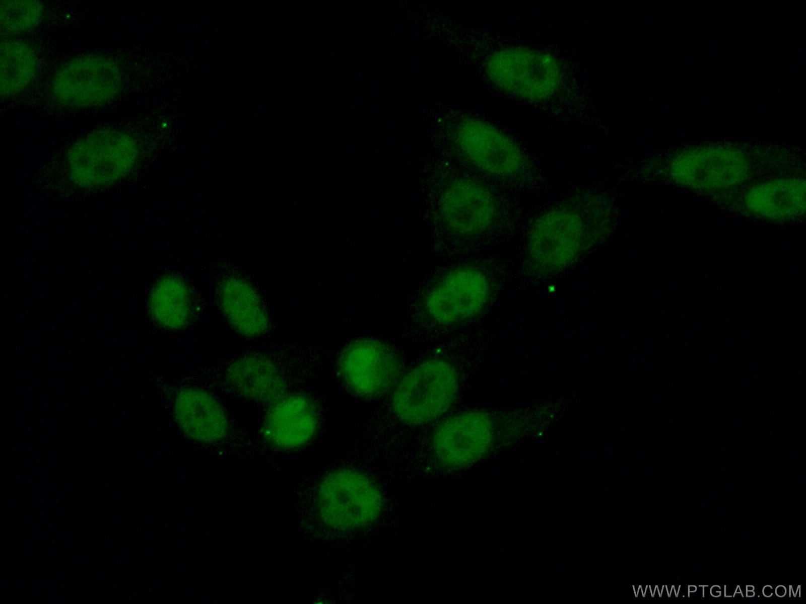 Immunofluorescence (IF) / fluorescent staining of HeLa cells using UBA2 Polyclonal antibody (15347-1-AP)