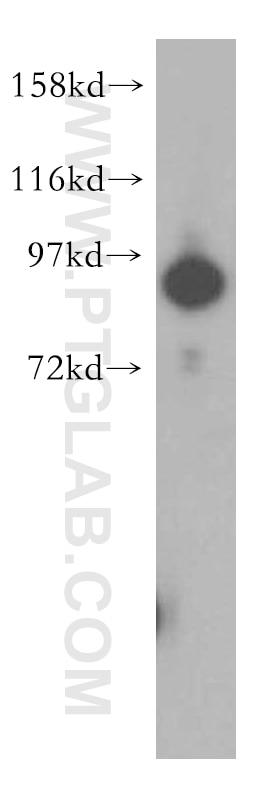 Western Blot (WB) analysis of human brain tissue using UBA2 Polyclonal antibody (15347-1-AP)